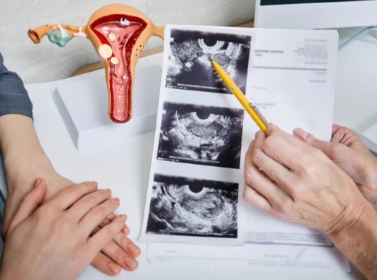 婦人科イメージ