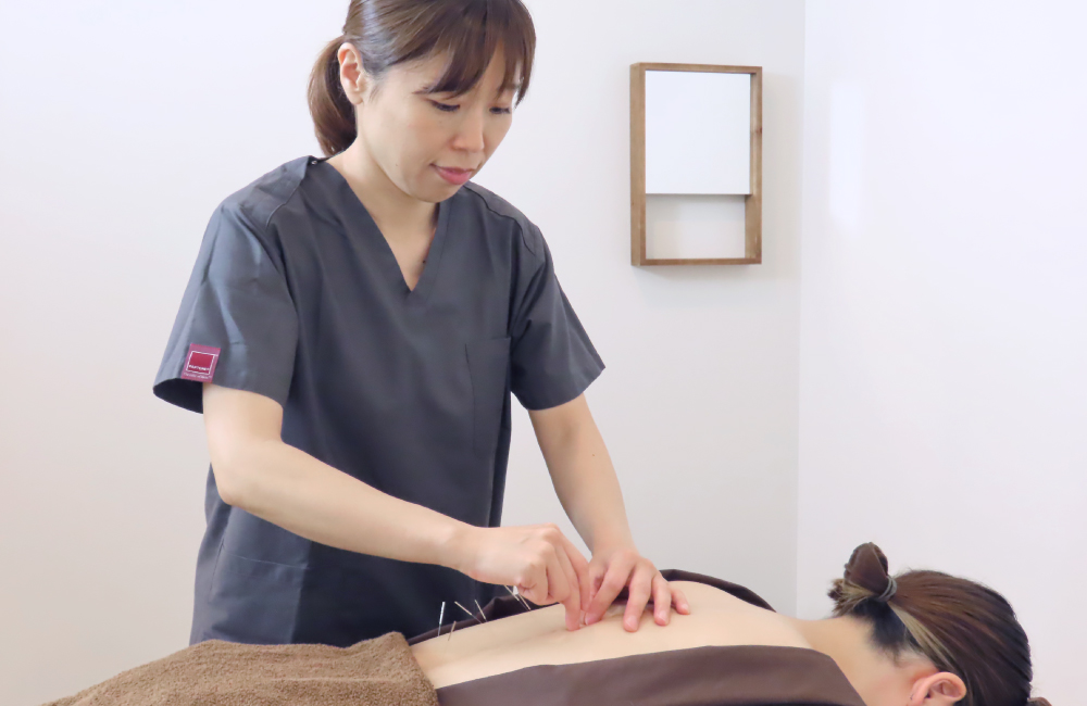 新橋の不妊治療・不妊鍼灸サロン ファンクショナルマッサージ治療室の体質改善の鍼灸施術写真