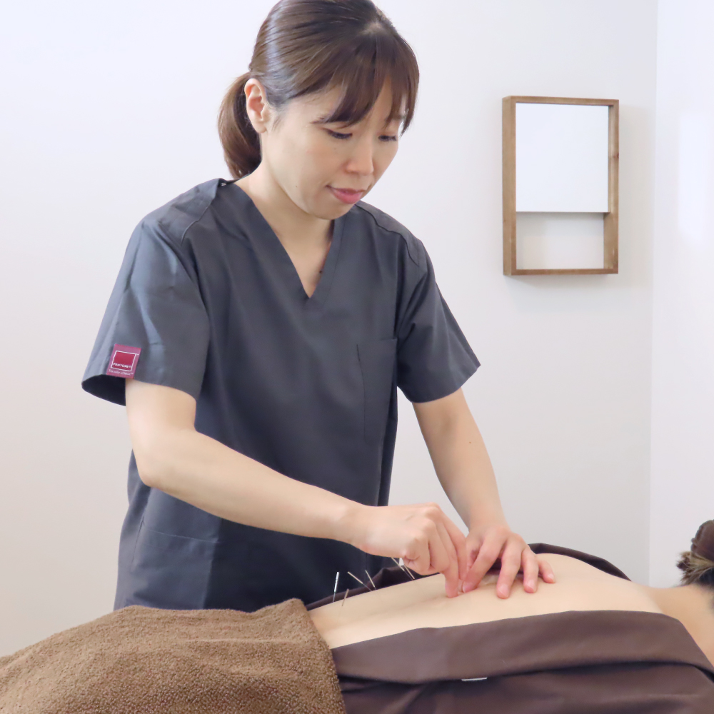 新橋の不妊治療・不妊鍼灸サロン ファンクショナルマッサージ治療室の体質改善の鍼灸施術写真