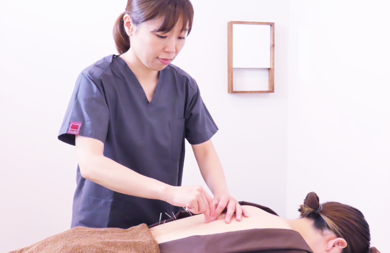 体質改善の鍼灸を受ける女性